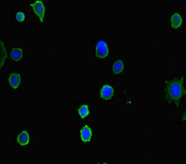 HDAC5 Antibody - Immunofluorescent analysis of MCF7 cells diluted at 1:100 and Alexa Fluor 488-congugated AffiniPure Goat Anti-Rabbit IgG(H+L)