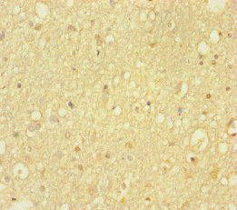 HDAC5 Antibody - Immunohistochemistry of paraffin-embedded human brain tissue at dilution of 1:100