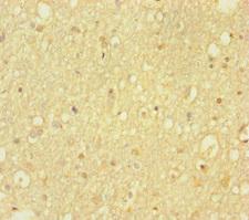 HDAC5 Antibody - Immunohistochemistry of paraffin-embedded human brain tissue at dilution of 1:100