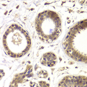 HDAC5 Antibody - Immunohistochemistry of paraffin-embedded human mammary gland using HDAC5 antibody at dilution of 1:100 (40x lens).