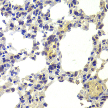 HDAC5 Antibody - Immunohistochemistry of paraffin-embedded mouse lung using HDAC5 antibody at dilution of 1:100 (40x lens).