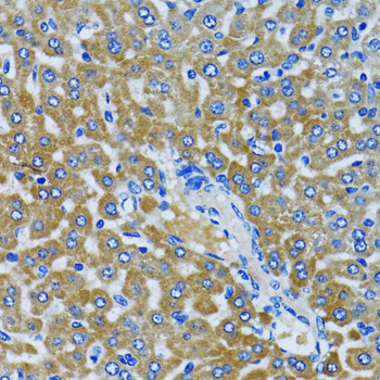 HDAC5 Antibody - Immunohistochemistry of paraffin-embedded rat liver using HDAC5 antibody at dilution of 1:100 (40x lens).