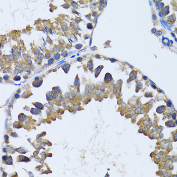 HDAC5 Antibody - Immunohistochemistry of paraffin-embedded mouse testis using HDAC5 antibody at dilution of 1:100 (40x lens).