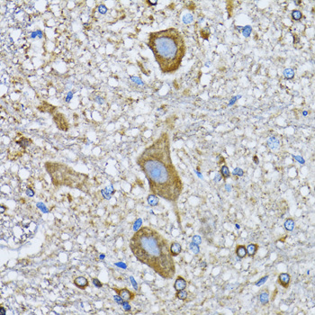 HDAC5 Antibody - Immunohistochemistry of paraffin-embedded mouse spinal cord using HDAC5 antibody at dilution of 1:100 (40x lens).
