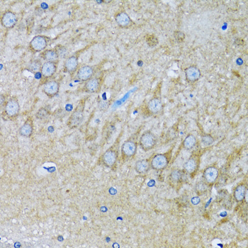 HDAC5 Antibody - Immunohistochemistry of paraffin-embedded mouse brain using HDAC5 antibody at dilution of 1:100 (40x lens).