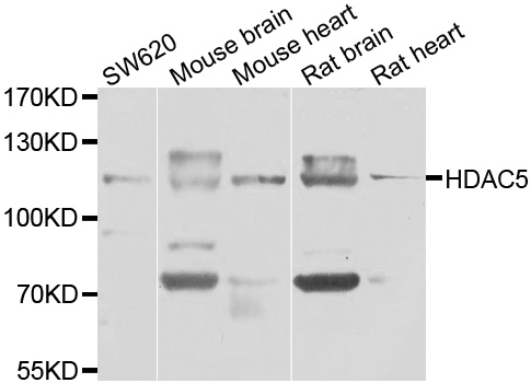 HDAC5 Antibody - Western blot analysis of extracts of various cell lines, using HDAC5 antibody at 1:1000 dilution. The secondary antibody used was an HRP Goat Anti-Rabbit IgG (H+L) at 1:10000 dilution. Lysates were loaded 25ug per lane and 3% nonfat dry milk in TBST was used for blocking. An ECL Kit was used for detection and the exposure time was 30s.