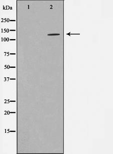 HDAC5 Antibody - Western blot analysis on NIH-3T3 cell lysates using HDAC5 antibody. The lane on the left is treated with the antigen-specific peptide.