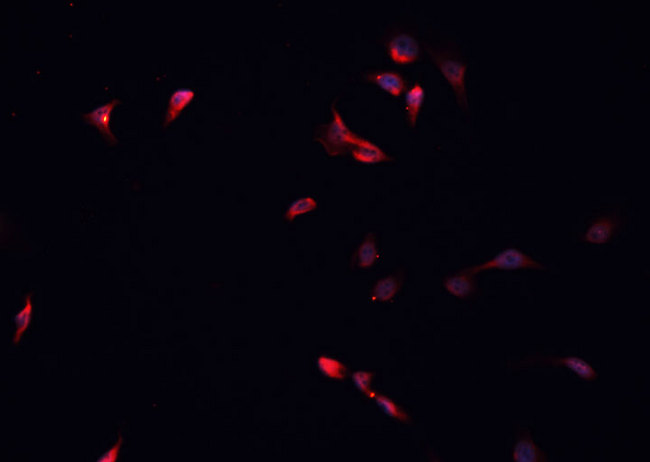 HDAC5 Antibody - Staining HeLa cells by IF/ICC. The samples were fixed with PFA and permeabilized in 0.1% Triton X-100, then blocked in 10% serum for 45 min at 25°C. The primary antibody was diluted at 1:200 and incubated with the sample for 1 hour at 37°C. An Alexa Fluor 594 conjugated goat anti-rabbit IgG (H+L) antibody, diluted at 1/600, was used as secondary antibody.