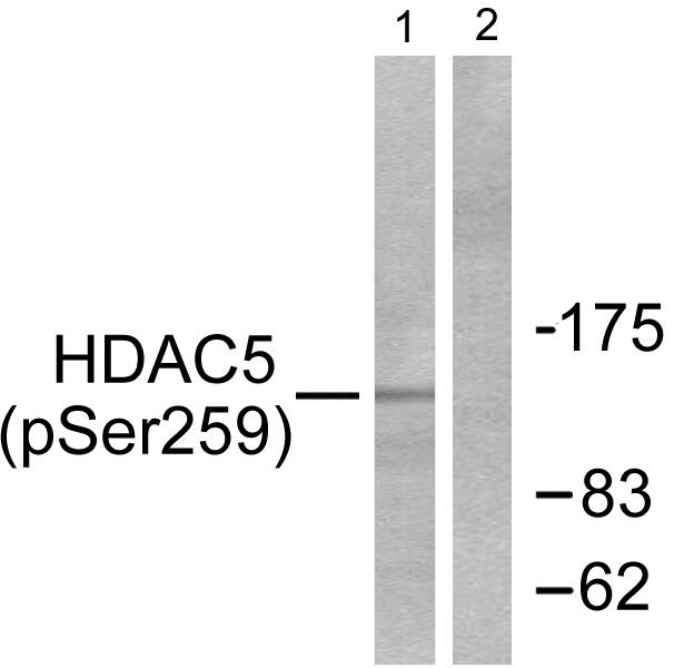 HDAC5 Antibody - Western blot analysis of lysates from HepG2 cells, using HDAC5 (Phospho-Ser259) Antibody. The lane on the right is blocked with the phospho peptide.