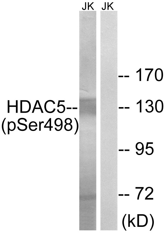 HDAC5 Antibody - Western blot analysis of lysates from Jurkat cells, using HDAC5 (Phospho-Ser498) Antibody. The lane on the right is blocked with the phospho peptide.