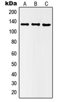 HDAC5 Antibody - Western blot analysis of Histone Deacetylase 5 (pS498) expression in HEK293T LPS-treated (A); Raw264.7 TNFa-treated (B); rat kidney (C) whole cell lysates.