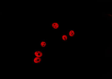 HDAC5 Antibody - Staining HeLa cells by IF/ICC. The samples were fixed with PFA and permeabilized in 0.1% Triton X-100, then blocked in 10% serum for 45 min at 25°C. The primary antibody was diluted at 1:200 and incubated with the sample for 1 hour at 37°C. An Alexa Fluor 594 conjugated goat anti-rabbit IgG (H+L) Ab, diluted at 1/600, was used as the secondary antibody.