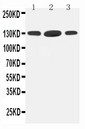 HDAC6 Antibody - WB of HDAC6 antibody. All lanes: Anti-HDAC6 at 0.5ug/ml. Lane 1: Rat Brain Tissue Lysate at 40ug. Lane 2: Rat Testis Tissue Lysate at 40ug. Lane 3: HELA Whole Cell Lysate at 40ug. Predicted bind size: 131KD. Observed bind size: 131KD.