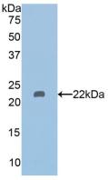 HDAC6 Antibody - Western Blot; Sample: Recombinant HDAC6, Human.