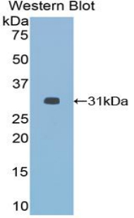 HDAC6 Antibody - Western blot of recombinant HDAC6.  This image was taken for the unconjugated form of this product. Other forms have not been tested.