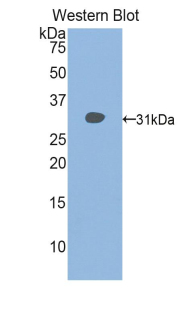 HDAC6 Antibody - Western blot of recombinant HDAC6.  This image was taken for the unconjugated form of this product. Other forms have not been tested.