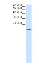 HDAC6 Antibody - HDAC6 antibody Western blot of 293T cell lysate. This image was taken for the unconjugated form of this product. Other forms have not been tested.