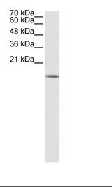 HDAC6 Antibody - 293T Cell Lysate.  This image was taken for the unconjugated form of this product. Other forms have not been tested.