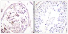 HDAC6 Antibody - Peptide - + Immunohistochemistry analysis of paraffin-embedded human testis tissue using HDAC6 antibody.