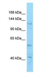 HDAC6 Antibody - HDAC6 antibody Western Blot of Mouse Testis.  This image was taken for the unconjugated form of this product. Other forms have not been tested.