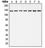 HDAC6 Antibody - Western blot analysis of Histone Deacetylase 6 expression in Jurkat (A); HeLa (B); NIH3T3 (C); K562 (D); MCF7 (E); mouse brain (F); rat brain (G) whole cell lysates.