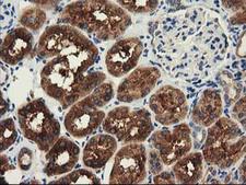 HDAC6 Antibody - IHC of paraffin-embedded Human Kidney tissue using anti-HDAC6 mouse monoclonal antibody.