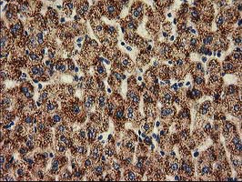 HDAC6 Antibody - IHC of paraffin-embedded Human liver tissue using anti-HDAC6 mouse monoclonal antibody.