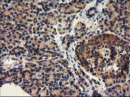 HDAC6 Antibody - IHC of paraffin-embedded Human pancreas tissue using anti-HDAC6 mouse monoclonal antibody.