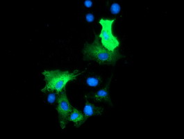 HDAC6 Antibody - Anti-HDAC6 mouse monoclonal antibody immunofluorescent staining of COS7 cells transiently transfected by pCMV6-ENTRY HDAC6.