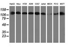 HDAC6 Antibody - Western blot analysis of extracts (35ug) from 9 different cell lines by using anti-HDAC6 monoclonal antibody.
