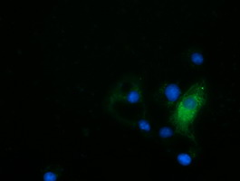 HDAC6 Antibody - Anti-HDAC6 mouse monoclonal antibody  immunofluorescent staining of COS7 cells transiently transfected by pCMV6-ENTRY HDAC6.