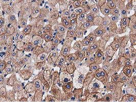 HDAC6 Antibody - IHC of paraffin-embedded Human liver tissue using anti-HDAC6 mouse monoclonal antibody. (Heat-induced epitope retrieval by 10mM citric buffer, pH6.0, 100C for 10min).
