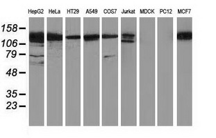 HDAC6 Antibody - Western blot of extracts (35ug) from 9 different cell lines by using anti-HDAC6 monoclonal antibody.