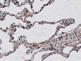 HDAC6 Antibody - IHC of paraffin-embedded Human lung tissue using anti-HDAC6 mouse monoclonal antibody. (Heat-induced epitope retrieval by 10mM citric buffer, pH6.0, 100C for 10min).