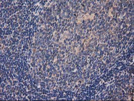 HDAC6 Antibody - IHC of paraffin-embedded Human lymph node tissue using anti-HDAC6 mouse monoclonal antibody. (Heat-induced epitope retrieval by 10mM citric buffer, pH6.0, 100C for 10min).