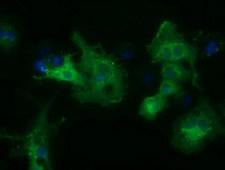 HDAC6 Antibody - Anti-HDAC6 mouse monoclonal antibody  immunofluorescent staining of COS7 cells transiently transfected by pCMV6-ENTRY HDAC6.