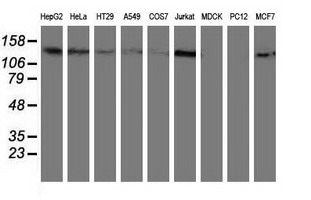 HDAC6 Antibody - Western blot of extracts (35 ug) from 9 different cell lines by using anti-HDAC6 monoclonal antibody.