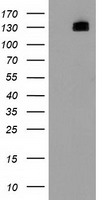 HDAC6 Antibody - HEK293T cells were transfected with the pCMV6-ENTRY control (Left lane) or pCMV6-ENTRY HDAC6 (Right lane) cDNA for 48 hrs and lysed. Equivalent amounts of cell lysates (5 ug per lane) were separated by SDS-PAGE and immunoblotted with anti-HDAC6.