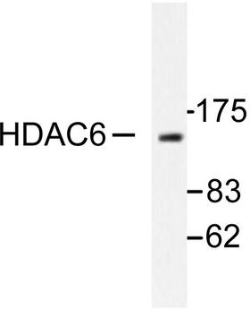 HDAC6 Antibody - Western blot of HDAC6 (H1203) pAb in extracts from HeLa cells.