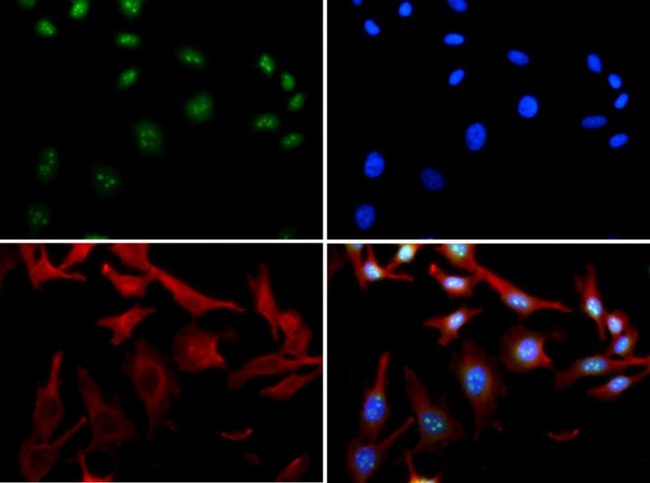 HDAC6 Antibody - Immunocytochemistry/Immunofluorescence: HDAC6 Antibody - HDAC-6 antibody was tested in HeLa cells with FITC (green). Nuclei and alpha-tubulin were counterstained with DAPI (blue) and Dylight 594 (red).  This image was taken for the unconjugated form of this product. Other forms have not been tested.