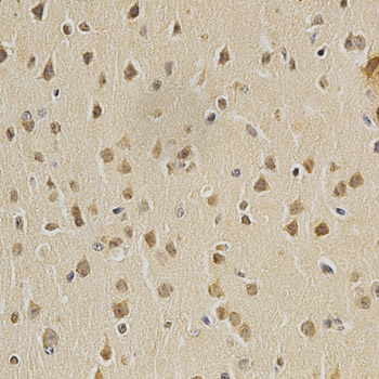 HDAC6 Antibody - Immunohistochemistry of paraffin-embedded mouse brain tissue.