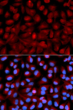 HDAC6 Antibody - Immunofluorescence analysis of U2OS cells.