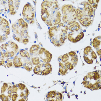 HDAC6 Antibody - Immunohistochemistry of paraffin-embedded human stomach using HDAC6 antibodyat dilution of 1:100 (40x lens).