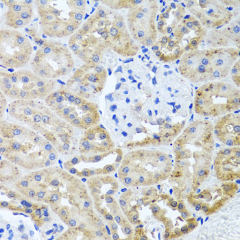 HDAC6 Antibody - Immunohistochemistry of paraffin-embedded rat kidney using HDAC6 antibodyat dilution of 1:100 (40x lens).
