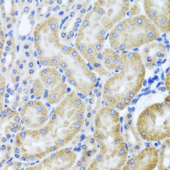 HDAC6 Antibody - Immunohistochemistry of paraffin-embedded mouse kidney using HDAC6 antibodyat dilution of 1:100 (40x lens).