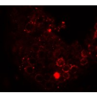 HDAC6 Antibody - Immunofluorescence of HDAC6 in human testis tissue with HDAC6 antibody at 20 µg/ml.