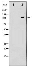 HDAC6 Antibody - Western blot of HDAC6 expression in HepG2 whole cell lysates,The lane on the left is treated with the antigen-specific peptide.