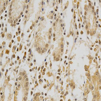 HDAC6 Antibody - Immunohistochemistry of paraffin-embedded human stomach using HDAC6 antibody at dilution of 1:100 (40x lens).