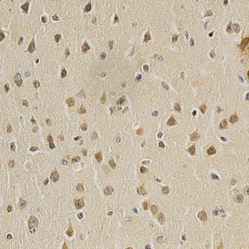 HDAC6 Antibody - Immunohistochemistry of paraffin-embedded mouse brain using HDAC6 antibody at dilution of 1:100 (40x lens).