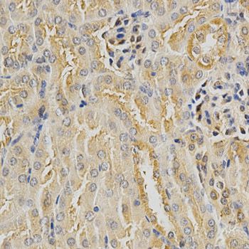 HDAC6 Antibody - Immunohistochemistry of paraffin-embedded mouse kidney using HDAC6 antibody at dilution of 1:100 (40x lens).